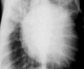 Kiểm soát và ngăn ngừa bệnh tim mạch ở chó, Dấu hiệu & cách điều trị